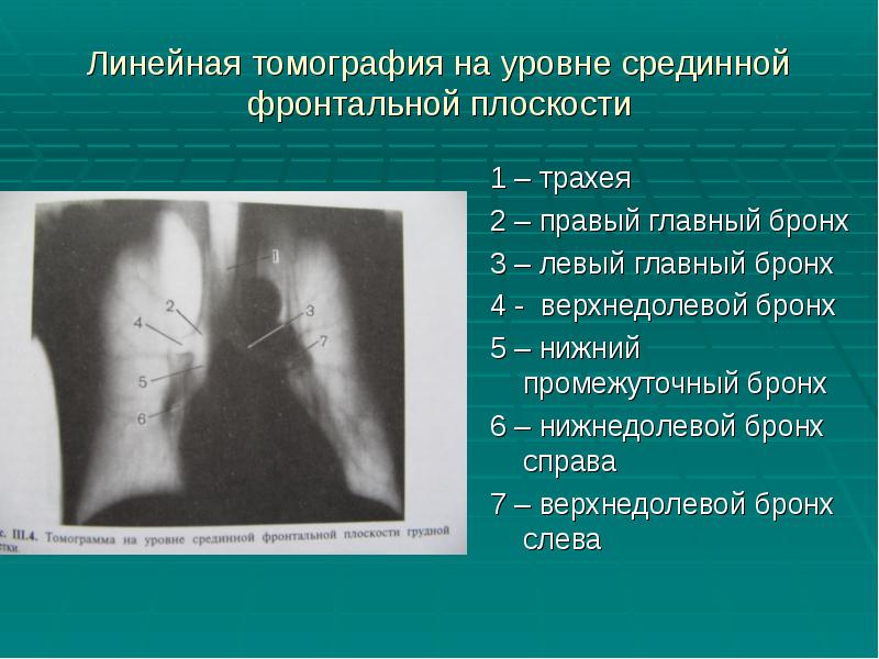 Фотодинамическая диагностика основы и принцип метода презентация