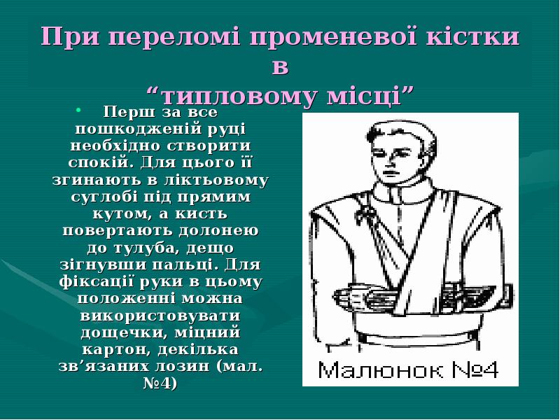 Презентація на тему перша допомога при переломах