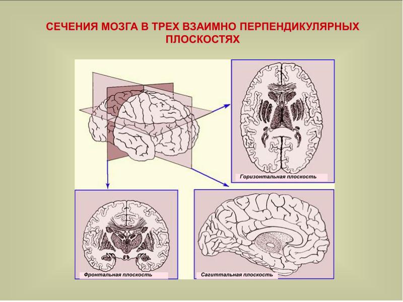 Диаграмма поперечного сечения головного мозга