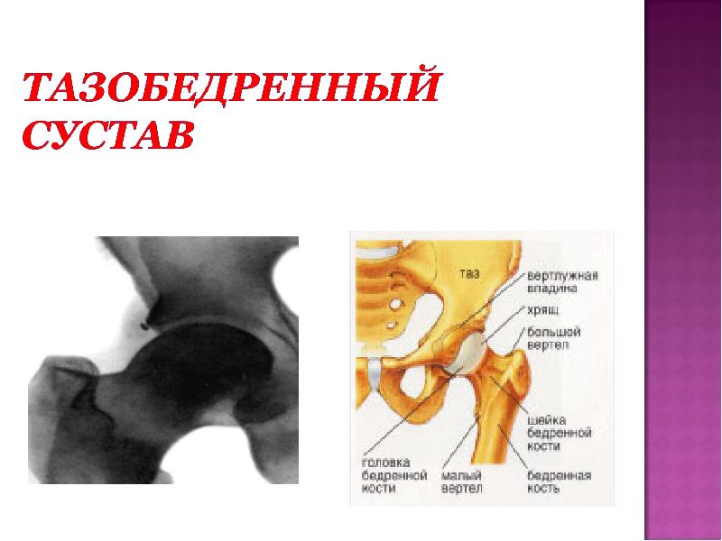 Вертел бедренной