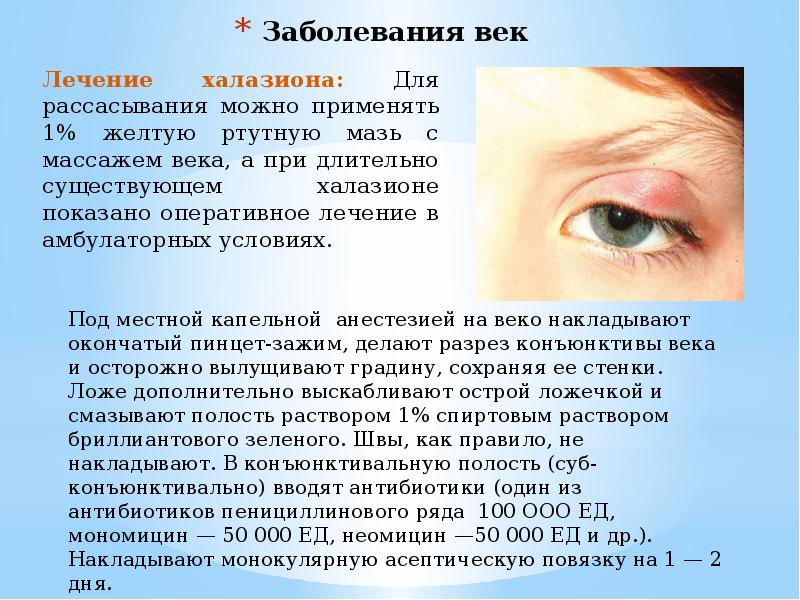 Лечение века глаза причины. Заболевания глаз доклад. Болезни глаза и придаточного аппарата. Заболевания век и слезного аппарата.