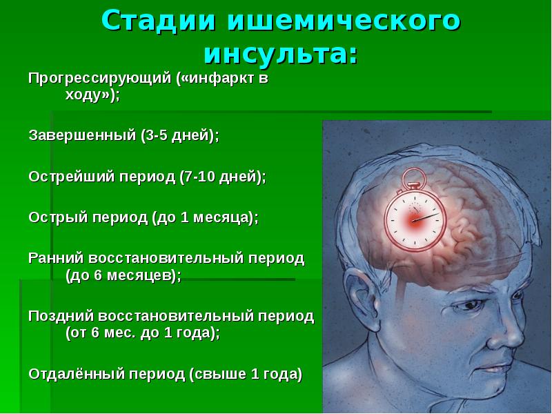 Презентация на тему ишемический инсульт головного мозга
