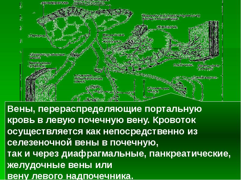 Портальная гипертензия хирургия презентация