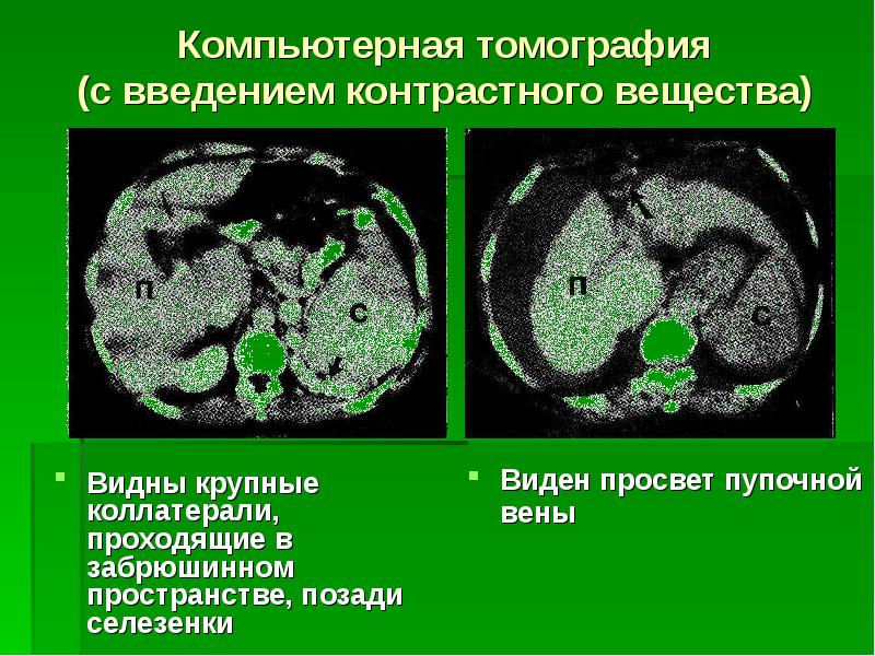 Кт без контраста