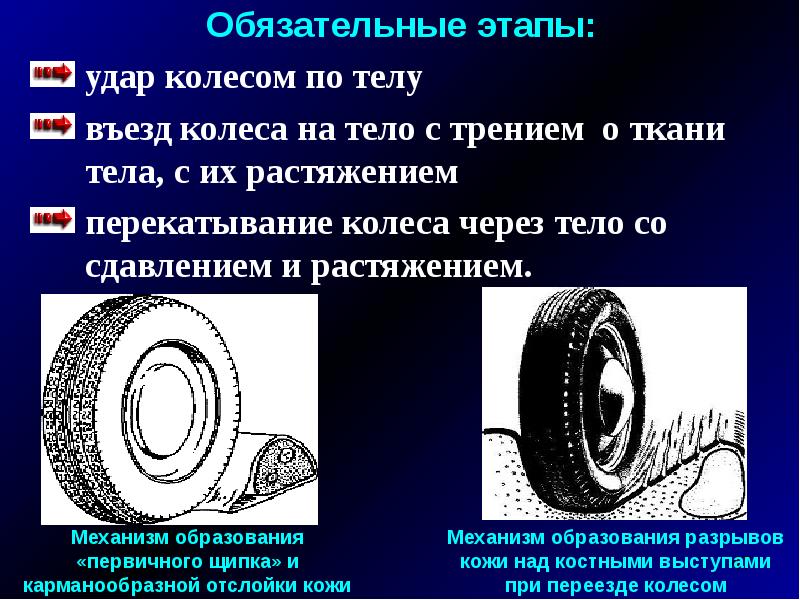 Диагностическим признаком переезда через тело колеса автомобильного транспортного средства является