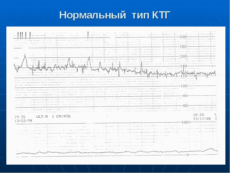 Карта ктг ограничений