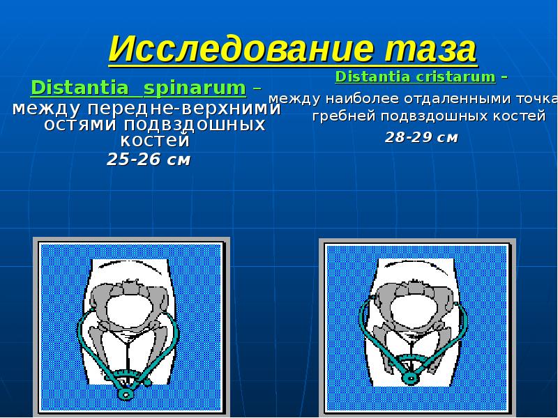 Исследование таза