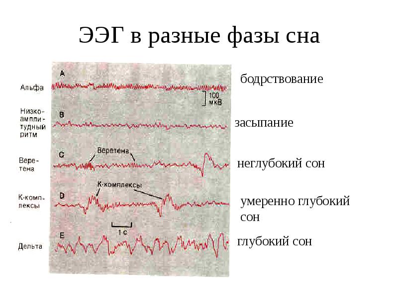 Фазы сна проект