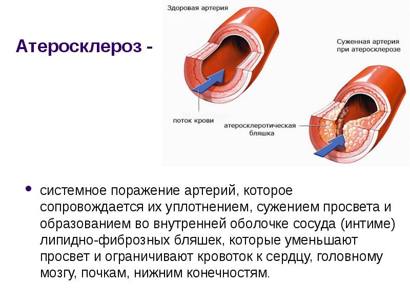 Состояние сосудистой стенки в норме