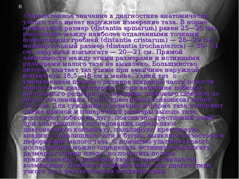 Определенное значение в диагностике анатомически узкого таза имеет наружное измерение таза.