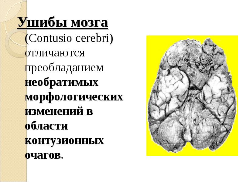 Черепно мозговая травма презентация