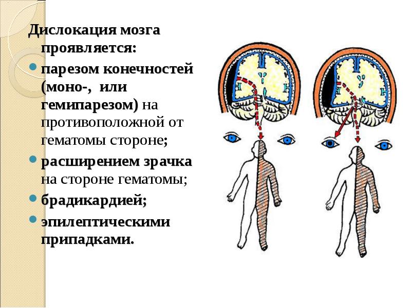 Признаки дислокации