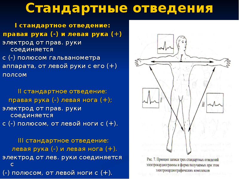 Положение v