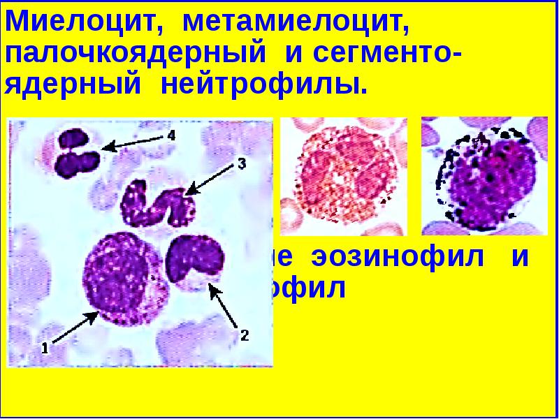 Миелоцит фото под микроскопом