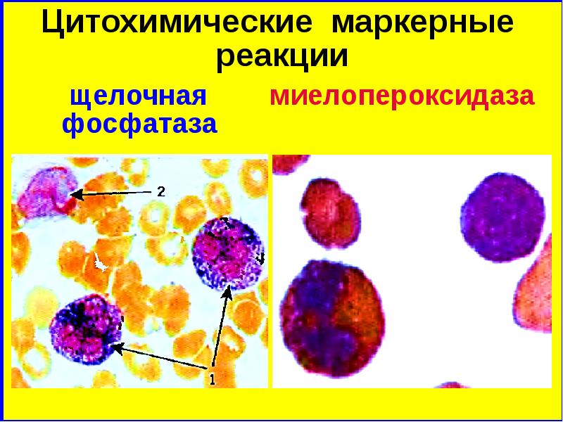 Реакция на лейкоциты положительная. Цитохимические исследования. Цитохимические методы исследования. Морфология гранулоцитарных клеток. Клетки гранулоцитарного ряда.