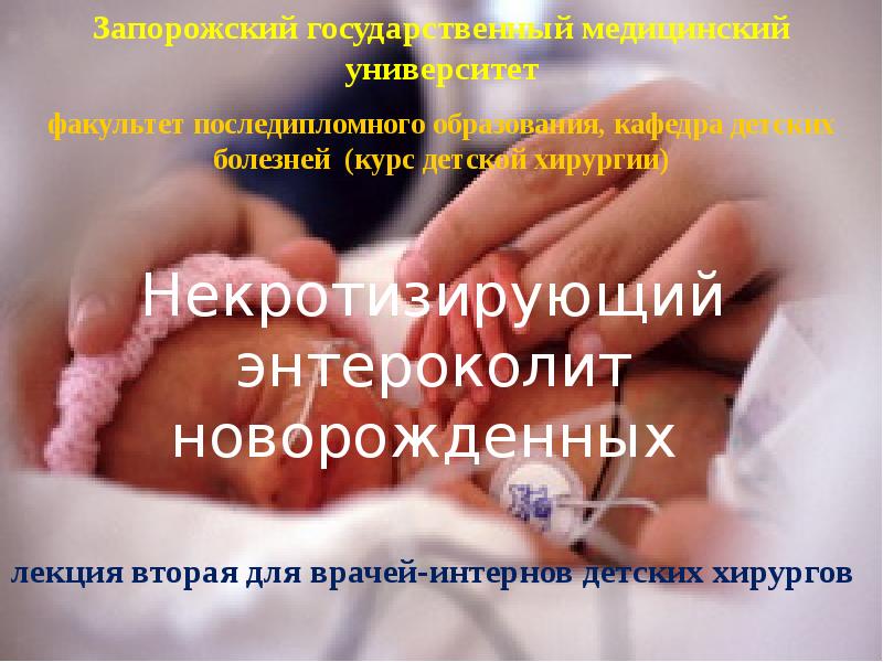 Нэк у новорожденных презентация