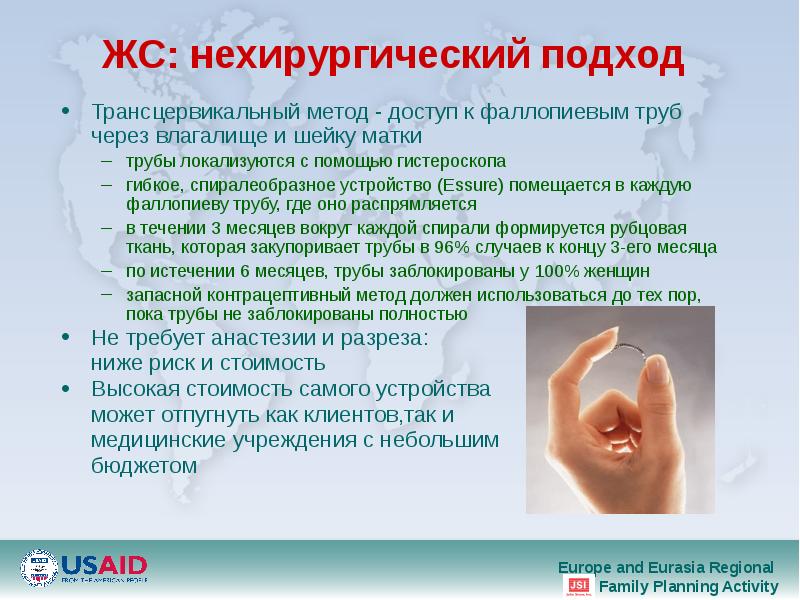 ЖС: нехирургический подход Трансцервикальный метод - доступ к фаллопиевым труб через