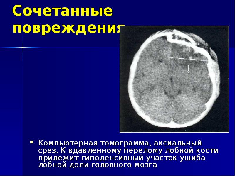 Лучевая диагностика головного мозга презентация