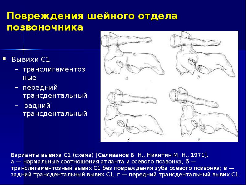 Повреждение шейного отдела позвоночника