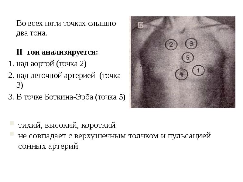 Шум остина флинта выслушивается в точке обозначенной на рисунке цифрой