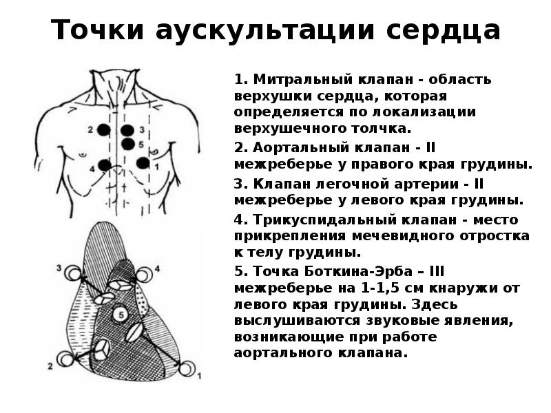 Аорта выслушивается. Точки аускультации клапанов сердца. Точка выслушивания аортального клапана. Точка Боткина при аускультации сердца. Точка аускультации митрального клапана.