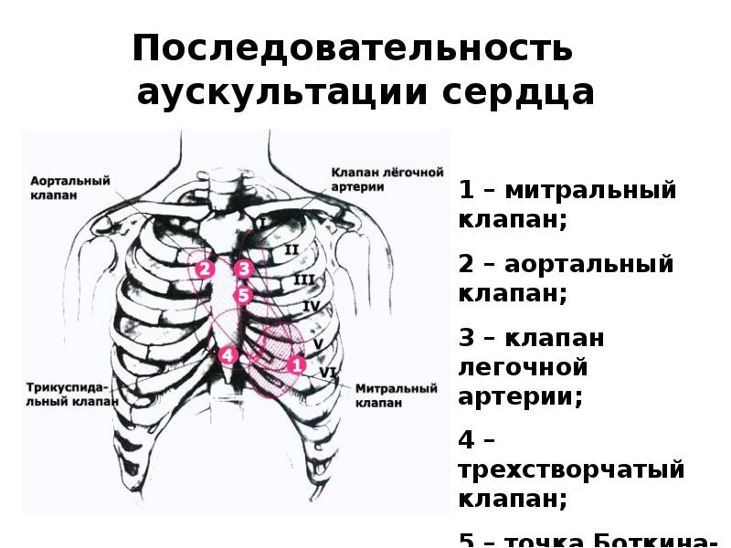 Аускультация сердца картинки