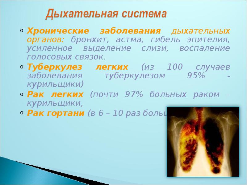 История возникновения табакокурения презентация