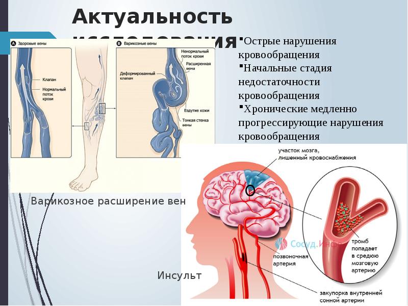 Периферическое кровообращение