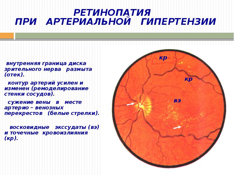 Патофизиология сосудистого тонуса презентация