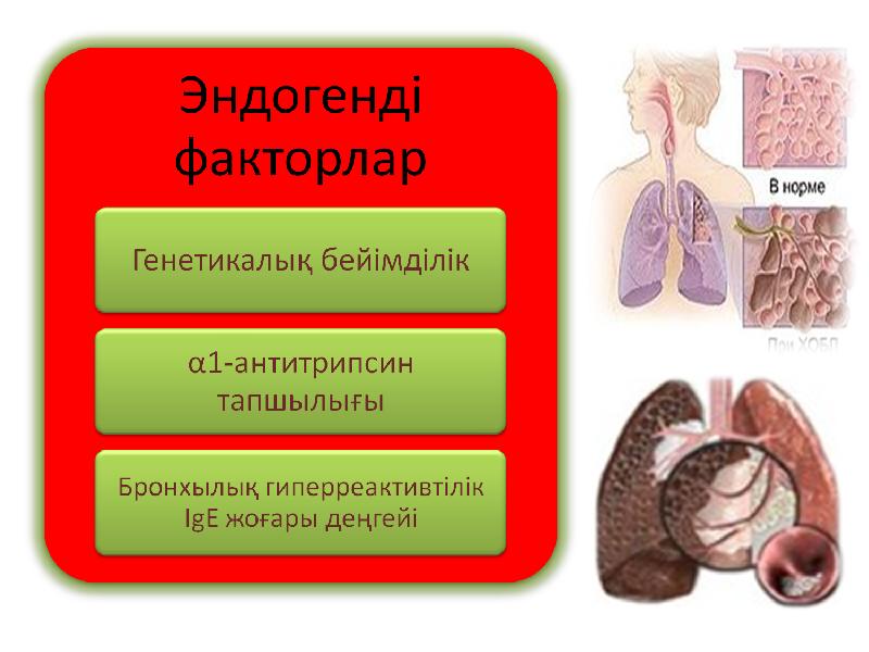 Презентация туберкулез ауруы