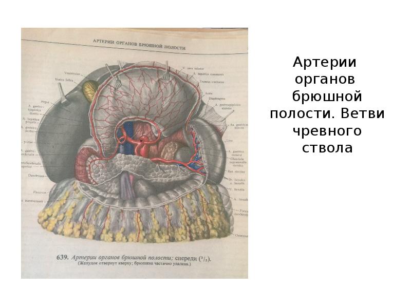 Чревный ствол рисунок