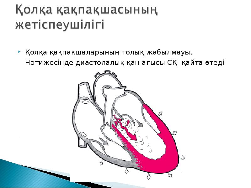 Жүрек ақаулары презентация