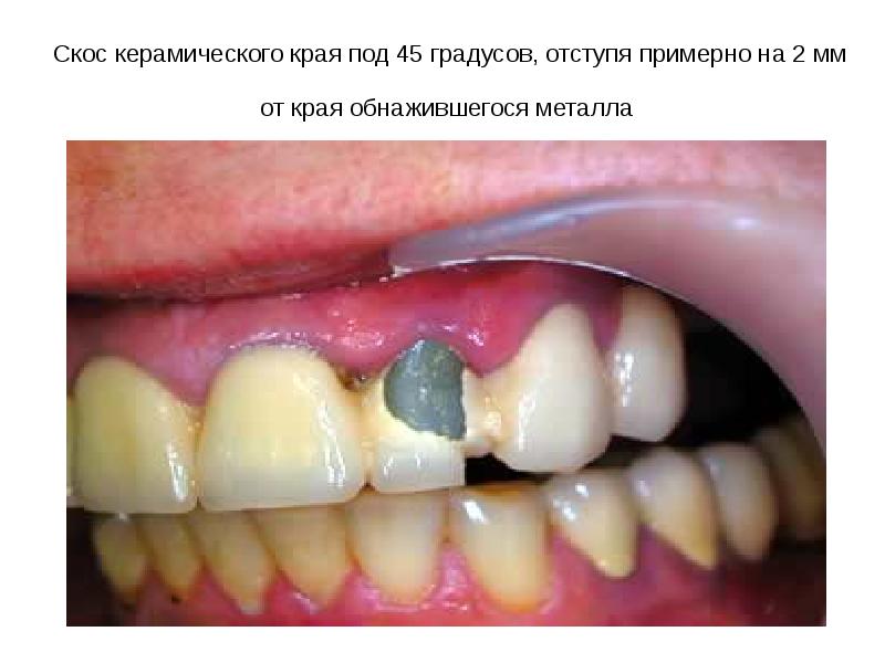 Скос керамического края под 45 градусов, отступя примерно на 2 мм