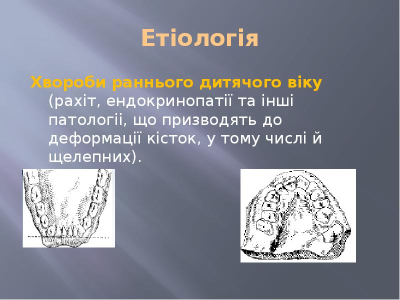 Етіологія Хвороби paнньoгo дитячого віку (рахіт, eндокринопатії та інші патологіі, що