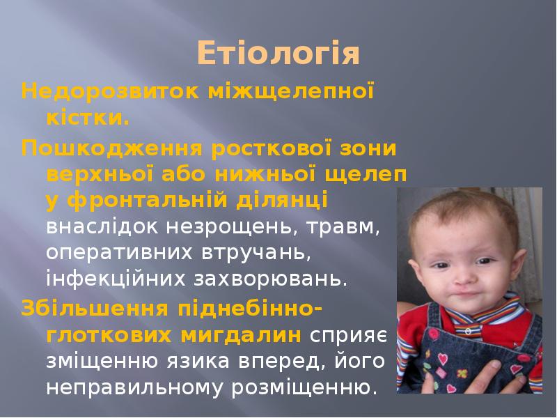 Етіологія Недорозвиток міжщелепної кістки. Пошкодження росткової зони верхньої або нижньої щелеп