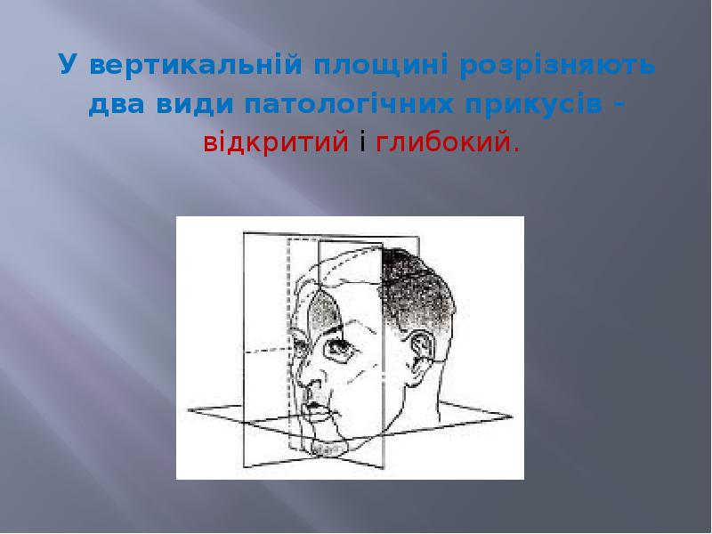 У вертикальній площині розрізняють  У вертикальній площині розрізняють  два