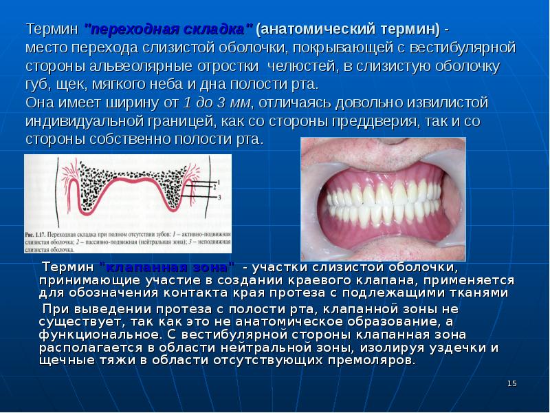 Методы фиксации и стабилизации съемных пластиночных протезов презентация