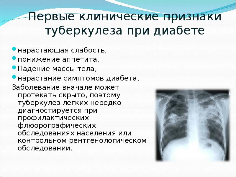 Туберкулез и сахарный диабет картинки thumbnail
