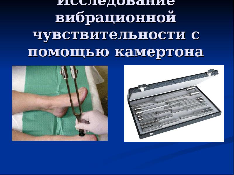 Исследование камертоном. Оценка вибрационной чувствительности. Определение вибрационной чувствительности камертоном. Вибрационная чувствительность норма. Общая чувствительность это.