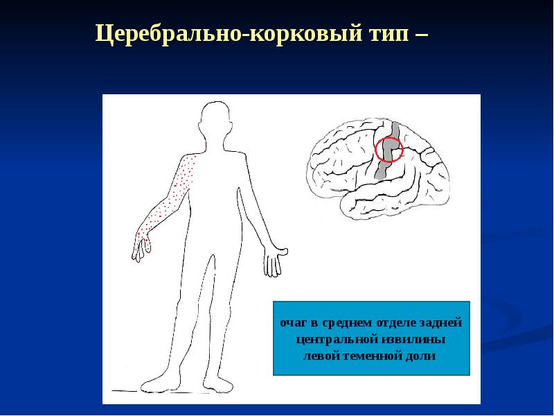 Нарушение чувствительности неврология презентация