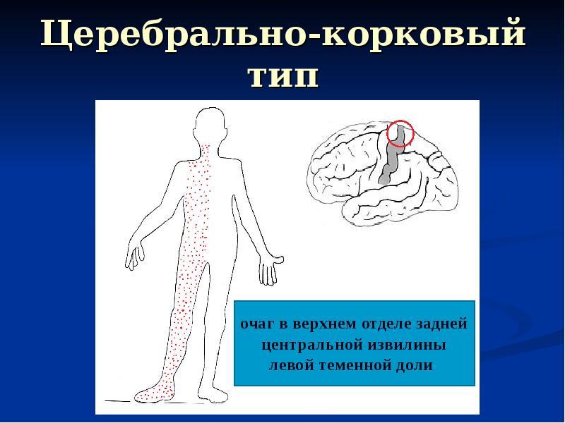 Поражение задней центральной извилины. Поражение задней центральной извилины симптомы. Симптомы поражения передней центральной извилины. Поражение верхнего отдела центральной извилины.