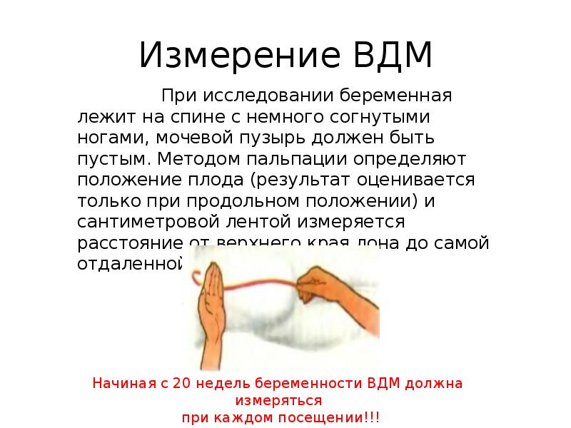 Высота стояния дна матки