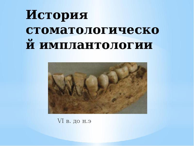 Презентация история стоматологии