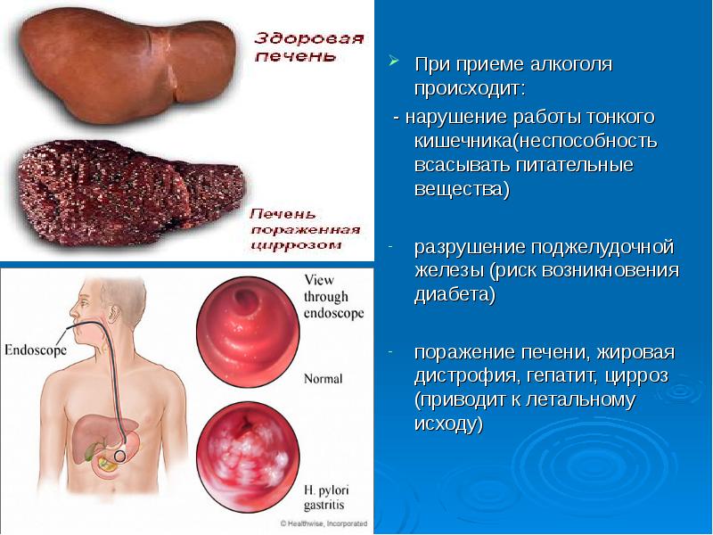 Влияние алкоголя на организм презентация