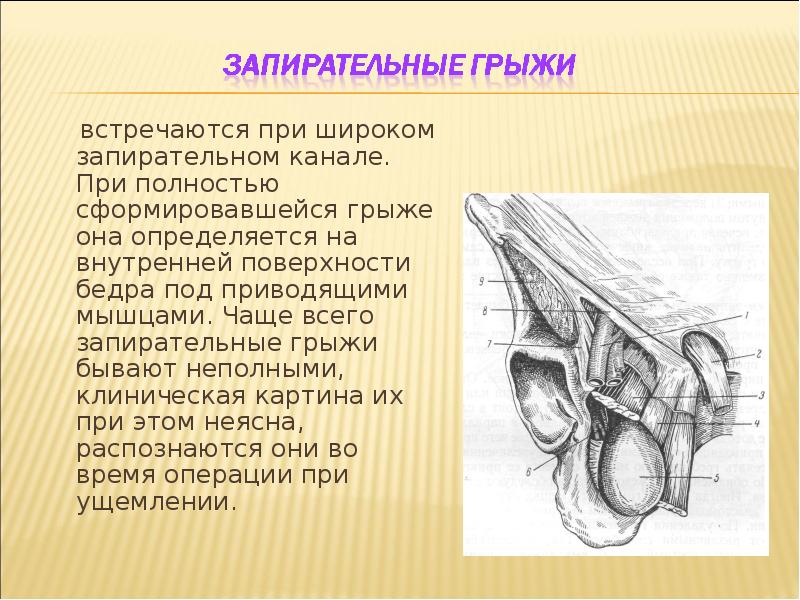 Клиническая картина грыжи живота