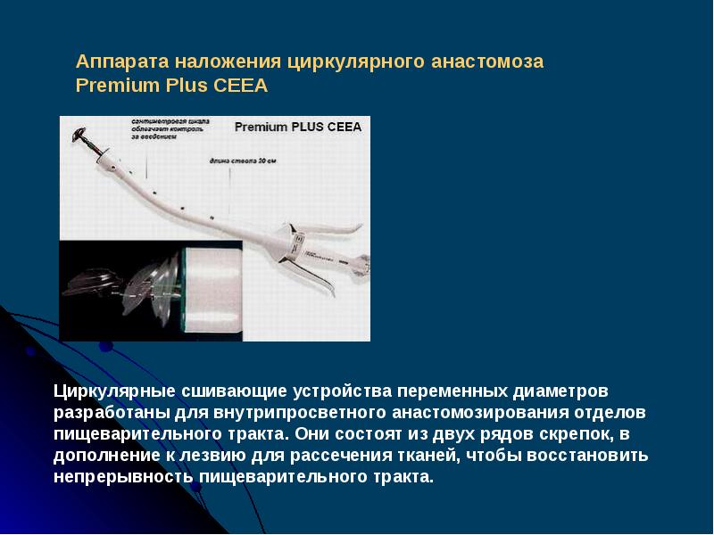 Проект разработанный для однократного применения называют