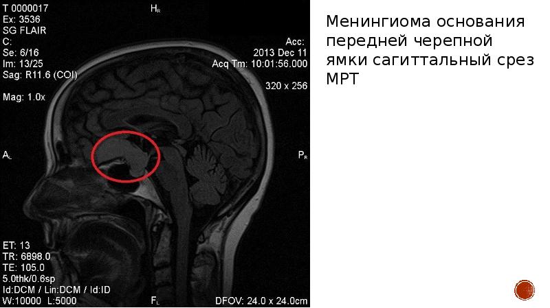 Оп 2 фото мозга в х16