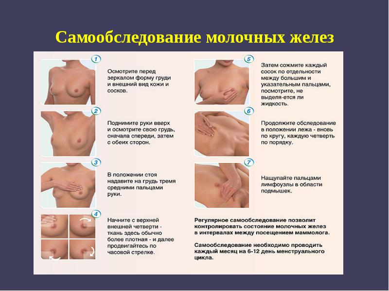 Самообследование молочных желез Самообследование молочных желез