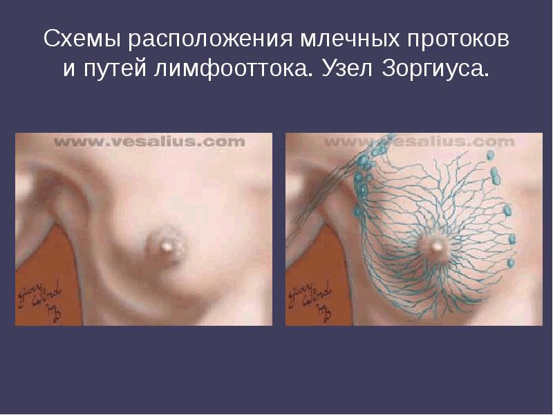 Схемы расположения млечных протоков и путей лимфооттока. Узел Зоргиуса. Схемы расположения млечных протоков и путей лимфооттока. Узел Зоргиуса.