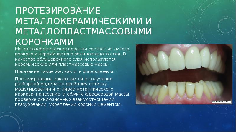 Пластмассы в стоматологии презентация